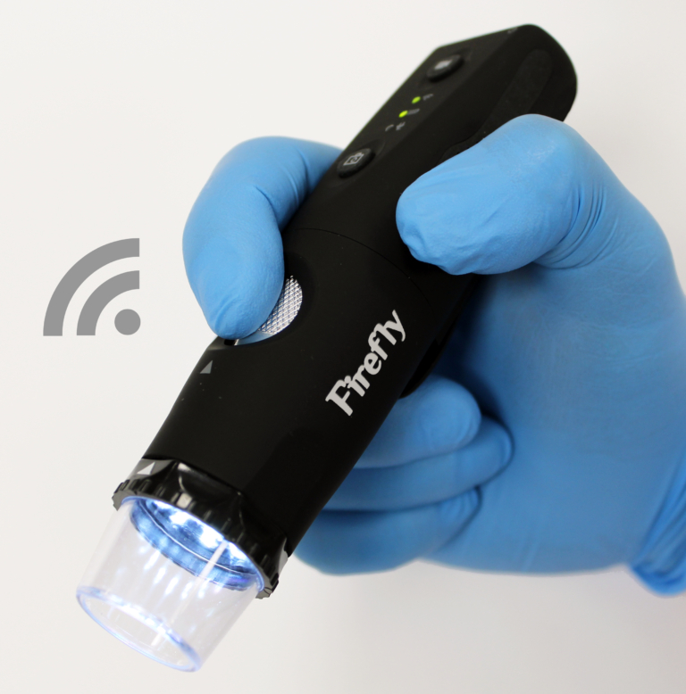 Digital Dermatoscope Firefly Global
