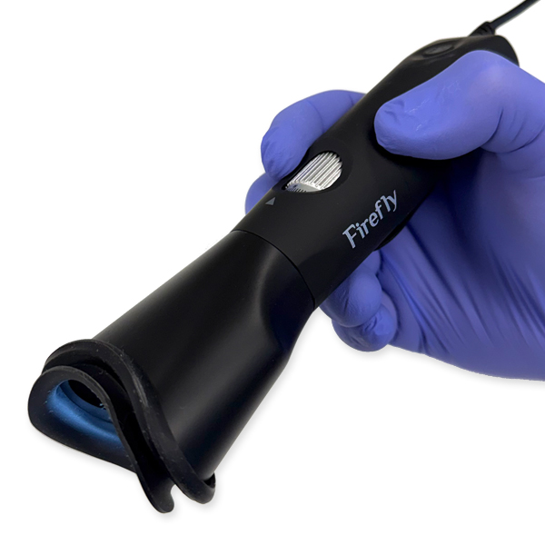 DE408 4k Iris Scope
